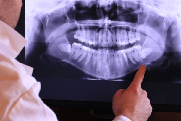 Best Emergency Root Canal Therapy in Jonesville, MI