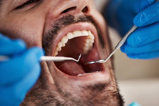 Best Emergency Dental Care for Sports Injuries in Jonesville, MI